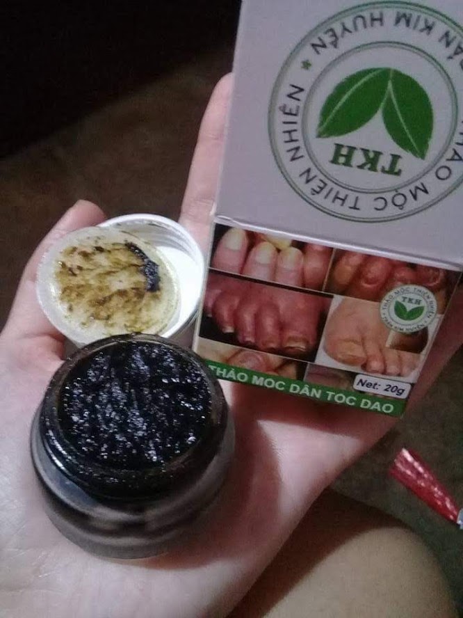 Dac Tri Benh Vay Nen Viem Da Co Dia Tran Kim Huyen 281